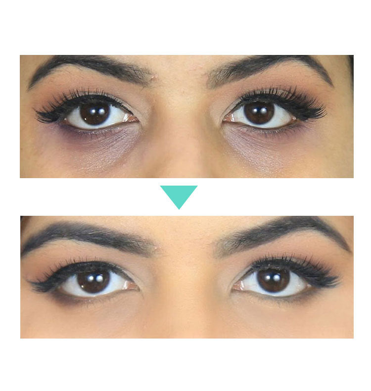 Beauty Eye LEVARIA™ LumiEyes Repair Cream – Hydrating Eye Care Treatment