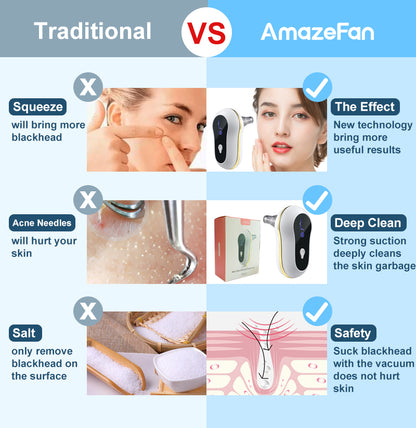 LEVARIA™ Limpiador de poros, succiona las imperfecciones del rostro, sin dolor y sin irritación.