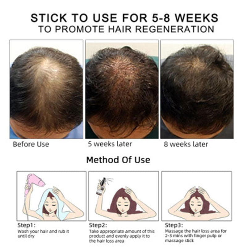 LEVARIA™ RootRevive Serum – Hair & Scalp Growth Treatment