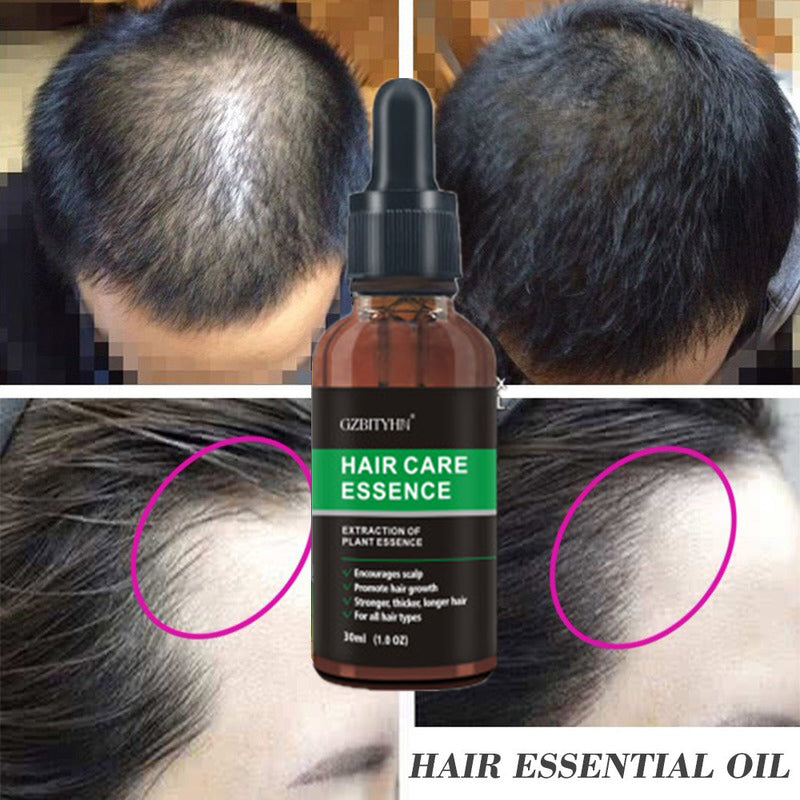 LEVARIA™ RootRevive Serum – Hair & Scalp Growth Treatment