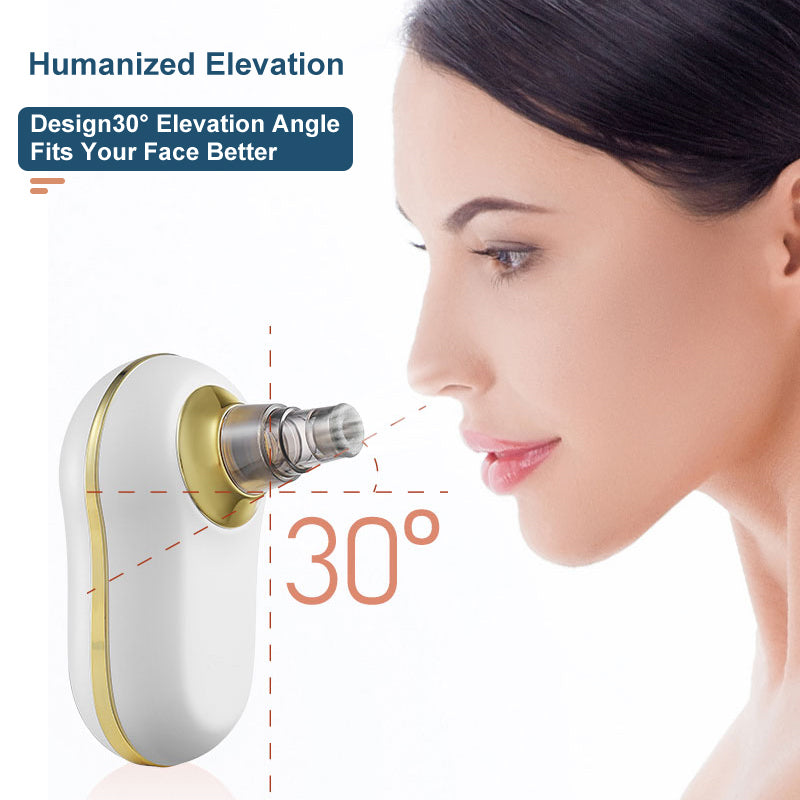 LEVARIA™ Limpiador de poros, succiona las imperfecciones del rostro, sin dolor y sin irritación.