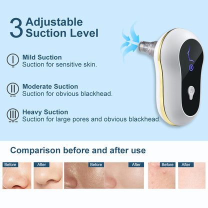 LEVARIA™ Limpiador de poros, succiona las imperfecciones del rostro, sin dolor y sin irritación.