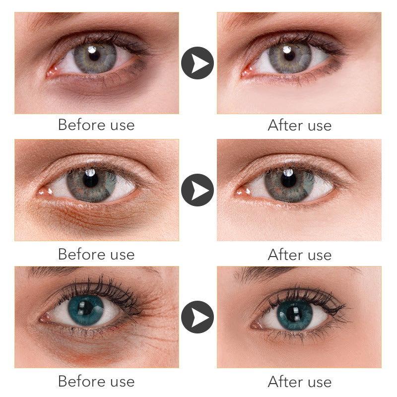 Beauty Eye LEVARIA™ LumiEyes Repair Cream – Hydrating Eye Care Treatment
