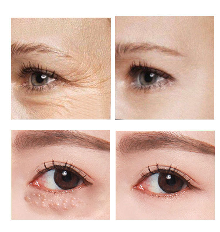 Beauty Eye LEVARIA™ LumiEyes Repair Cream – Hydrating Eye Care Treatment