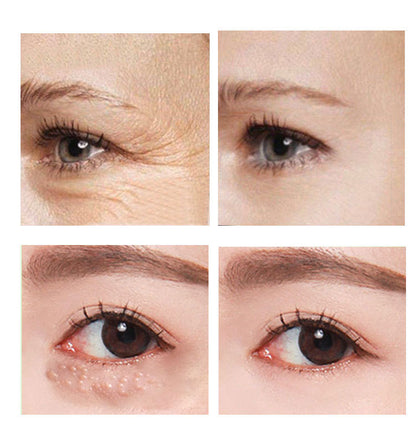 Beauty Eye LEVARIA™ LumiEyes Repair Cream – Hydrating Eye Care Treatment